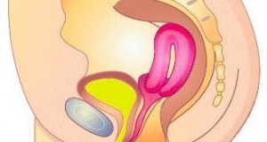 Retroverted Uterus Image Of Retroverted Uterus Pictures to pin on ...